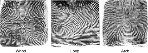 Figure 12 from Friction Ridge Skin : Morphogenesis and Overview Anatomy Outer Morphology of the ...