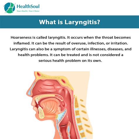 Laryngitis – Healthsoul