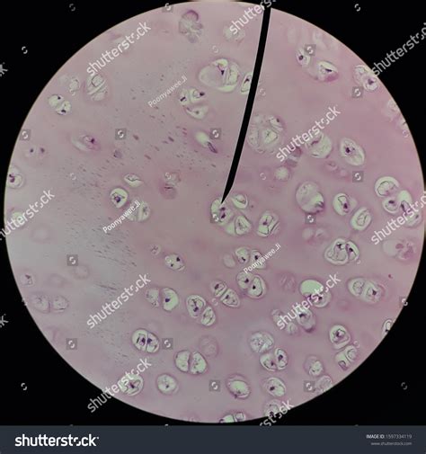 1 Chondrocyte Cluster Royalty-Free Photos and Stock Images | Shutterstock