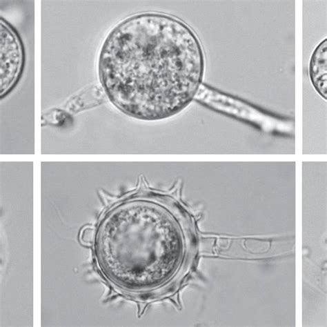 Effects of Pythium oligandrum strain D11 on seedling stands of soybean... | Download Scientific ...