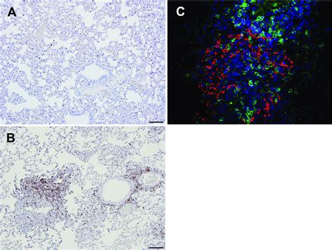 CD3+ cells in the lungs following primary infection and reinfection ...