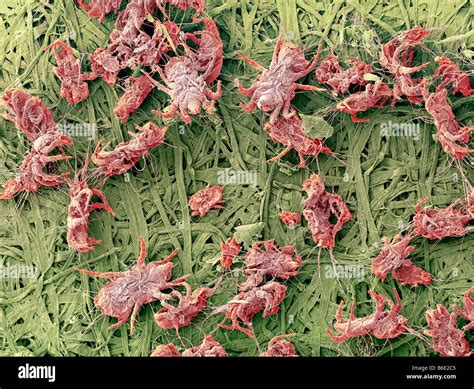 House dust microscope hi-res stock photography and images - Alamy