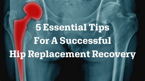 5 Essential Tips for a Successful Hip Replacement Recovery – Brian Johns