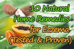 10 Natural Home Remedies for Eczema (Tested & Proven) - Cure Eczema Slowly