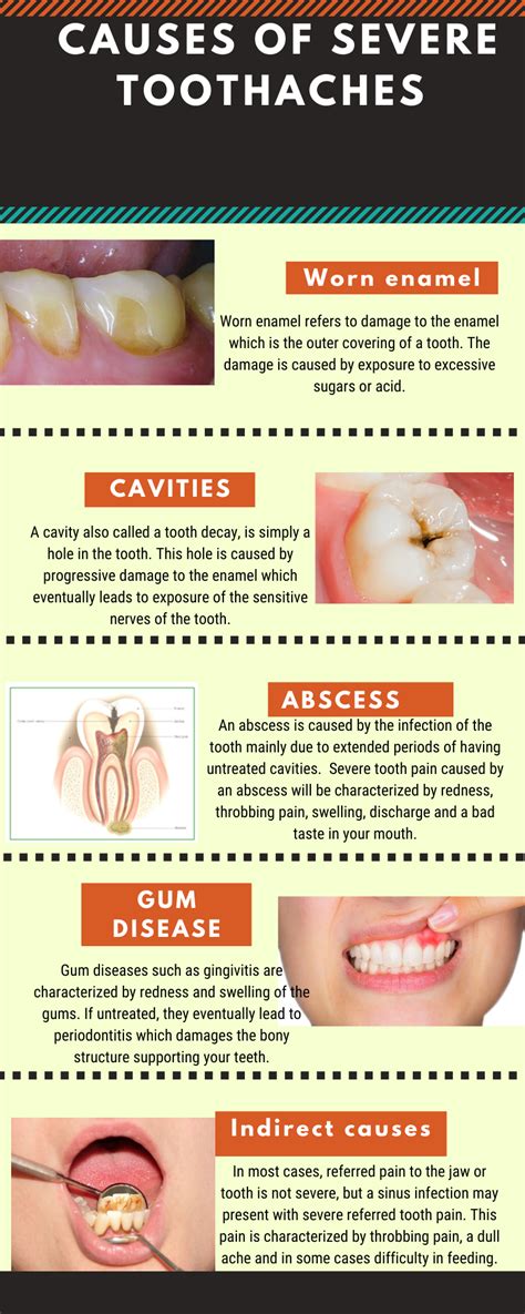 Causes Of Severe Toothaches | Severe tooth pain, Toothache, Tooth pain causes