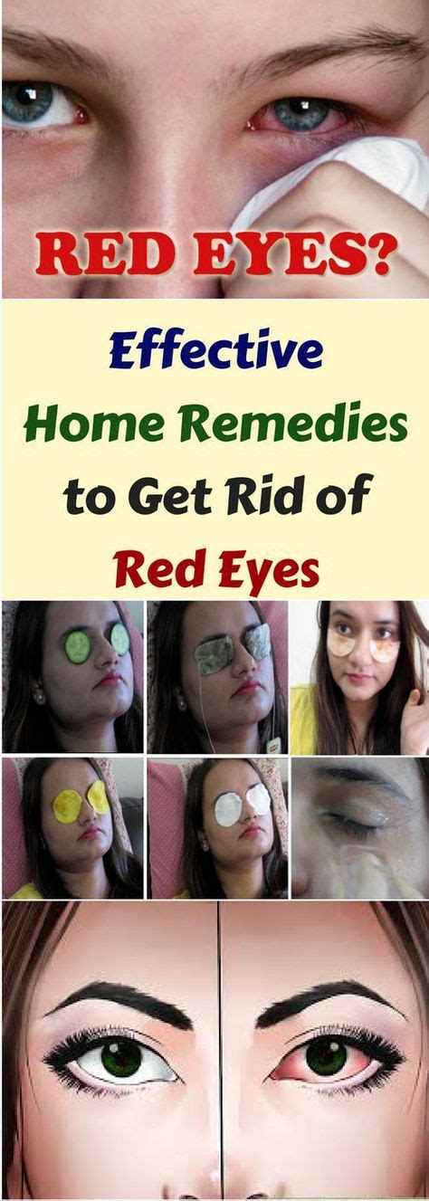 Effective Home Remedies To Get Rid Of Red Eyes!!! #wieghtloss #beautyhacks | Red eyes remedy ...