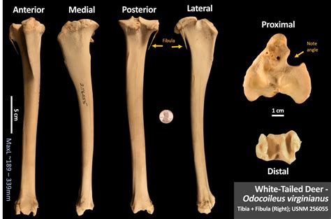 Bones – Page 16 – OsteoID Bone Identification