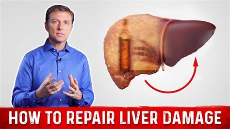 How To Repair Liver Damage After Alcohol? – Dr.Berg on Liver Cirrhosis - YouTube in 2022 | Liver ...