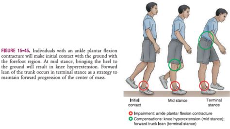 Abnormal Gait Flashcards | Quizlet