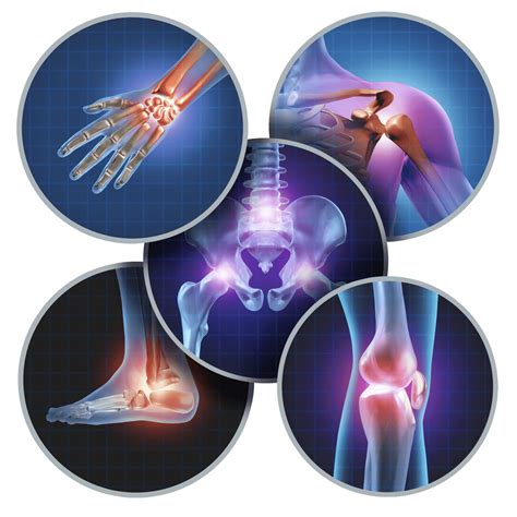 Osteoarthritis Treatments