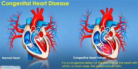 Calls on the government to continue services for those affected by congenital heart disease