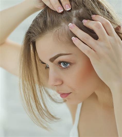 8 Simple Ways To Treat Hair Loss At The Temples