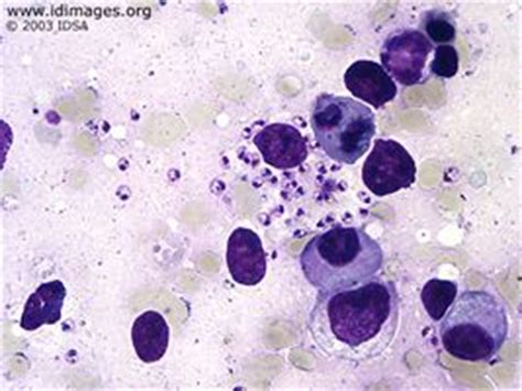 Leishmania donovani | Hematology, Microbiology lab, Pathology study