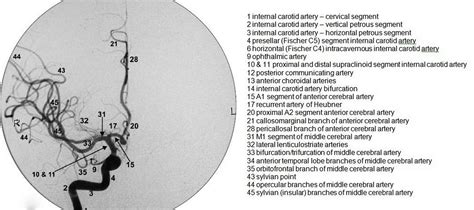 Dr Balaji Anvekar FRCR: Normal Brain Angiogram DSA