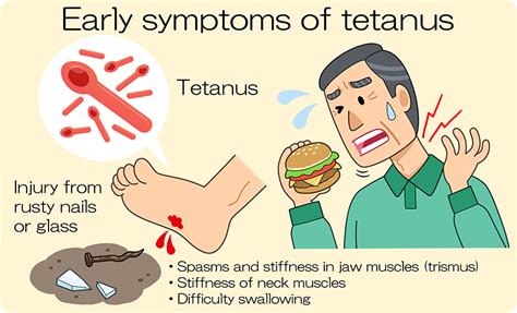 Tetanus | Serum therapy