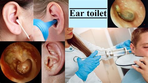 ear toilet - YouTube