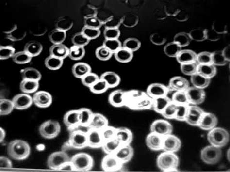 Live Blood Analysis Dark Field Microscopy Explained