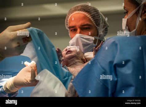 Cesarean birth Stock Photo - Alamy