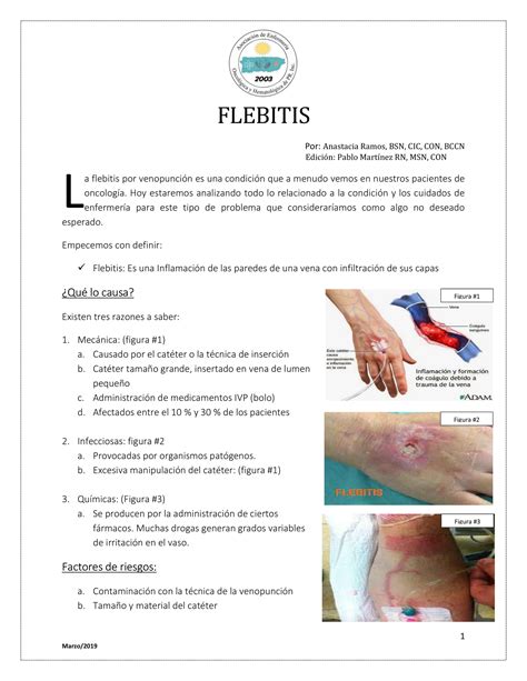 Flebitis