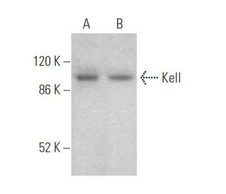 Anti-Kell Antibody (A-10) | SCBT - Santa Cruz Biotechnology