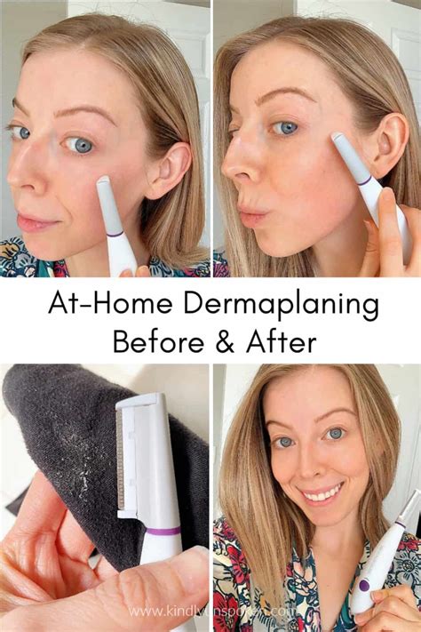 5 Benefits of Dermaplaning + The Best At-Home Tool! - Kindly Unspoken