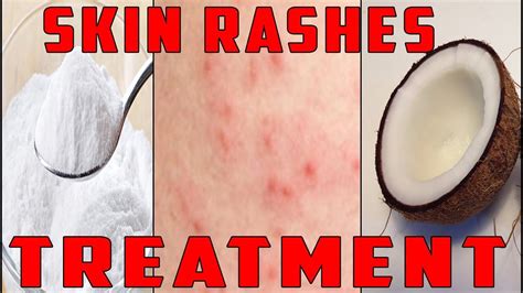 Dry Skin Rash Treatment