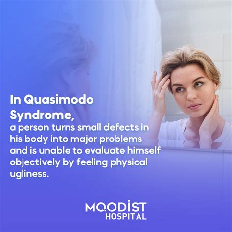 In Quasimodo syndrome, a person turns... - Moodist Hospital