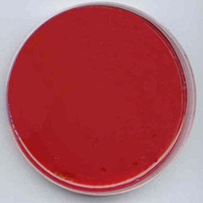 Eosin Methylene Blue Agar Results - dailyscoopsofpecansweets