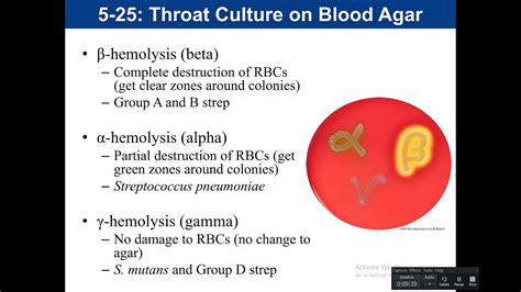 5-25, 5-26, 4-3: Throat cultures, CAMP test and Bile Esculin Agar - YouTube