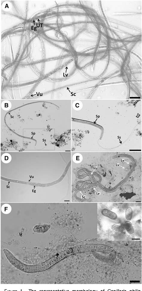 Figure 1 from A Hospital-Based Study of Intestinal Capillariasis in Thailand: Clinical Features ...