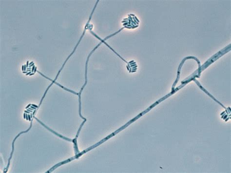 Fusarium - microconidia, phialospores