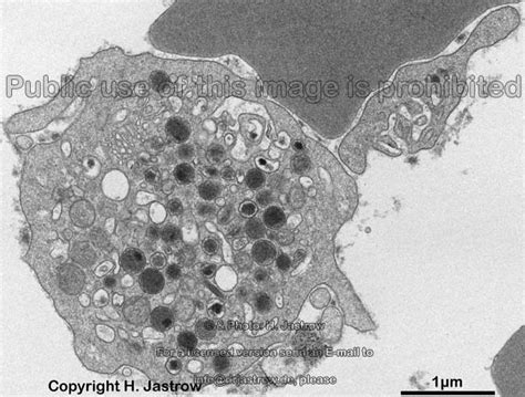 blood platelets Dr.Jastrow's electron microscopic atlas