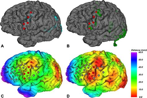 Accuracy analysis of fMRI and MEG activations determined by ...