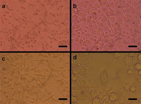 Photomicrographs of adherent cells after a) 1 day (scale bar=50 μm), b ...