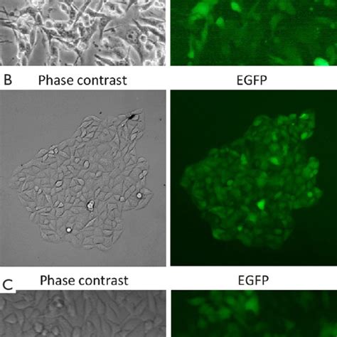 Fluorescent microscopy analysis. A. B16F10 cells stably transfected... | Download Scientific Diagram