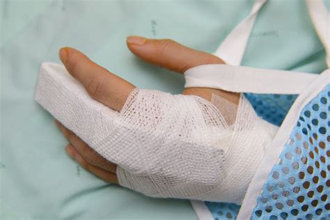 How to Treat a Broken Finger | All-Pro Orthopedics & Sports Medicine