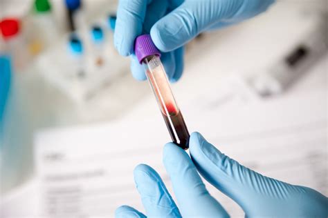 17-Hydroxyprogesterone Test: Normal Levels & Meaning - SelfHacked