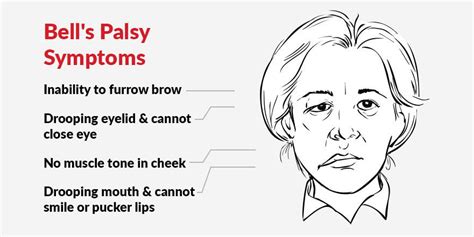 EMS Unit to Treat Bell's Palsy – Massage Therapy Concepts