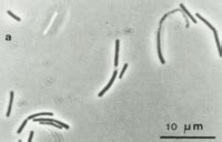 Methanobacterium palustre - microbewiki