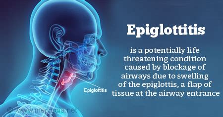 Health Tip on Epiglottitis - Health Tips