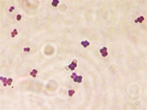 Gram Positive Cocci in Tetrads (Micrococcus spp.) | Micrococ… | Flickr - Photo Sharing!