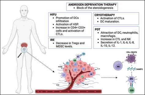 FOCAL THERAPY The Role of the Tumor Microenvironment in Prostate Cancer ...