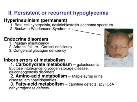 PPT - Hypoglycemia in Newborn Infants PowerPoint Presentation, free download - ID:6446434