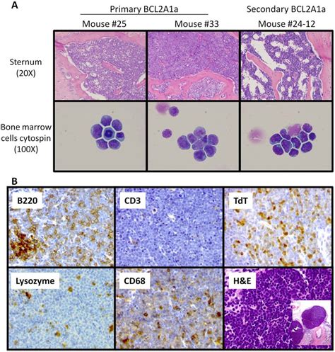 Analyses of bone marrow cells by microscopy after H&E staining and... | Download Scientific Diagram