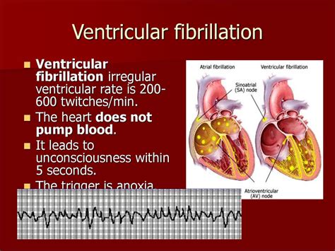 Heart pathology. (Subject 13) - презентация онлайн