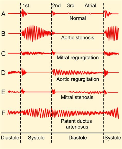 How to examine the heart and cardiovascular system (CVS) - Health ...