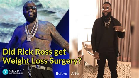 Did Rick Ross Get Weight Loss Surgery? - Mexico Bariatric Center®