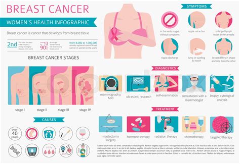 Breast cancer, medical infographic. Diagnostics, symptoms, treatment ...