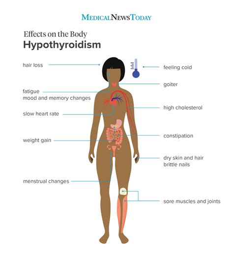 Symptoms of Hypothyroidism (underactive thyroid)