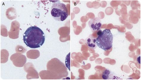 An unusual cause of anemia…